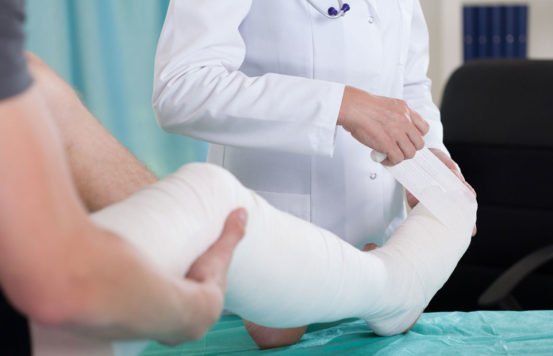 Injury leg in a cast